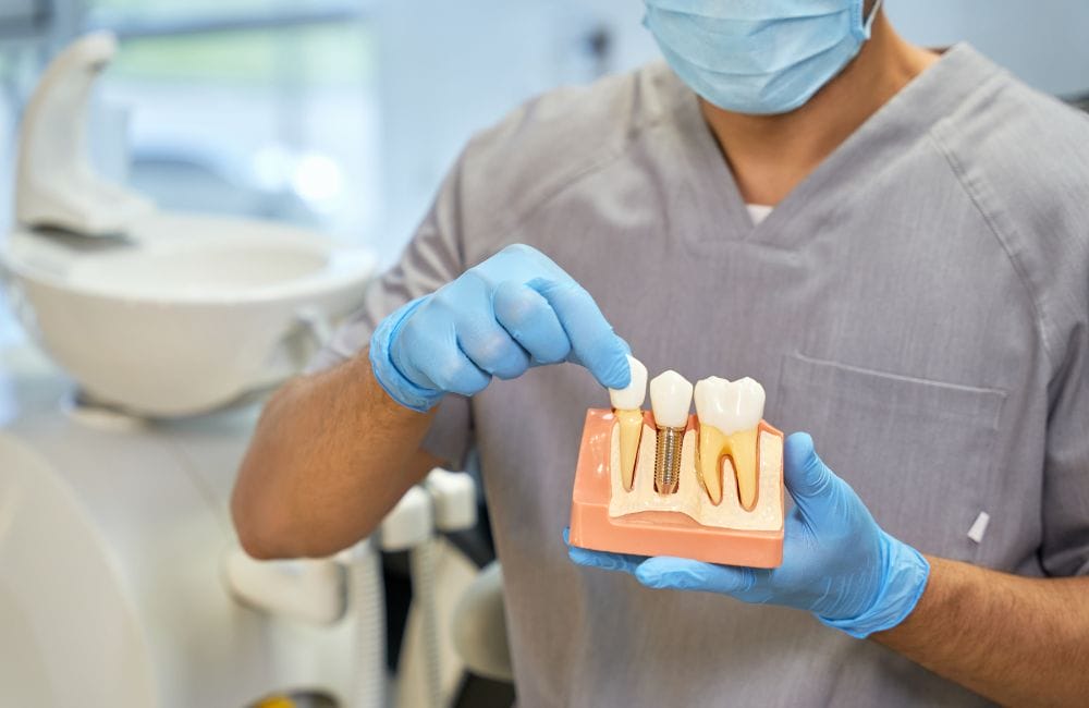 Dentist wearing gloves and a mask holding a model showing a dental implant next to natural teeth