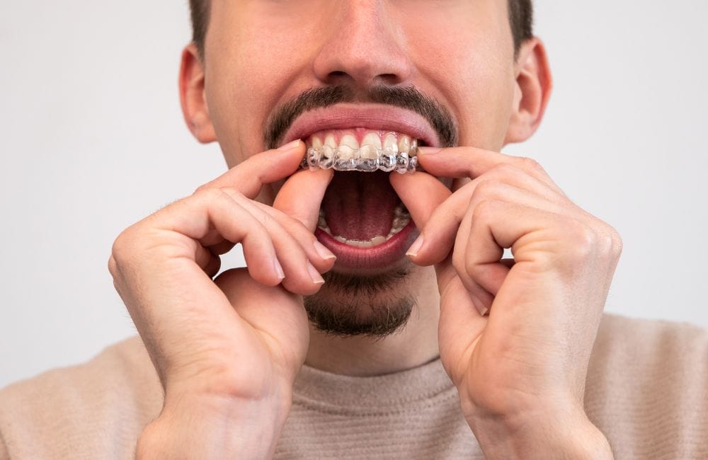 What Is Invisalign