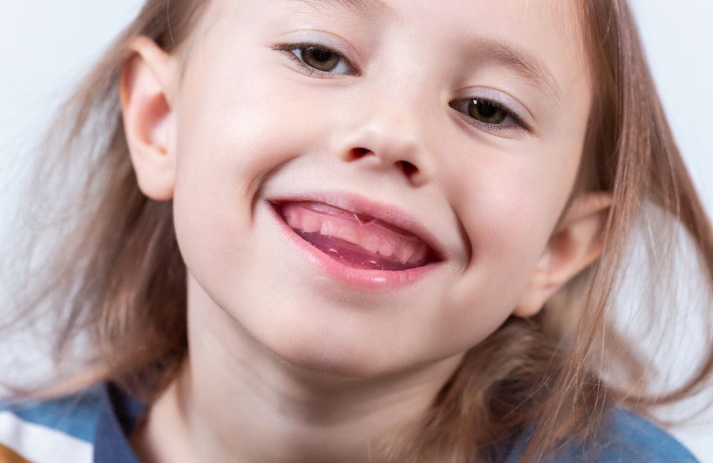 Young girl smiling and showing a missing front tooth as her permanent teeth grow in